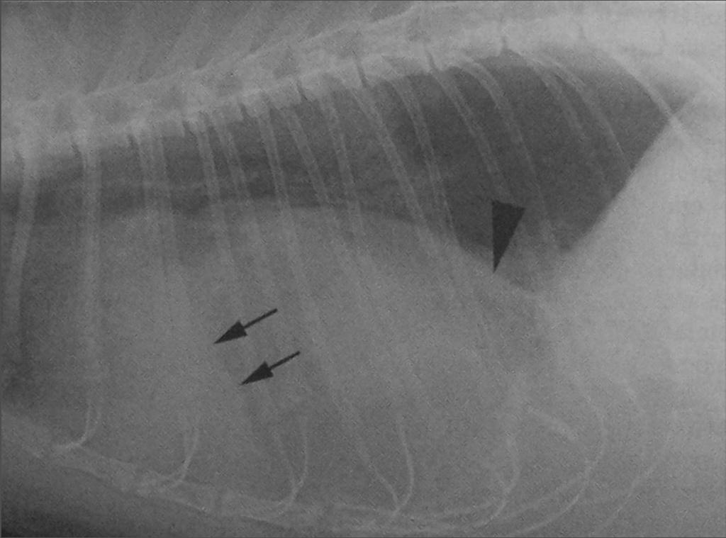 Gatto residuo del mesotelio peritoneopericardico Residuo