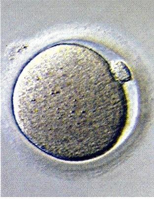 propri organi sessuali, delle cellule specializzate alla riproduzione chiamate GAMETI - GAMETE MASCHILE spermatozoo - GAMETE