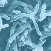 Caratterizzazione sensoriale dei batteri lattici Grazie a numerose collaborazioni scientifiche è stato possibile dimostrare che i batteri malolattici hanno un interazione significativa con molte