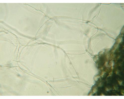 Parenchima acquifero - funzione di accumulo di acqua - tipico delle piante