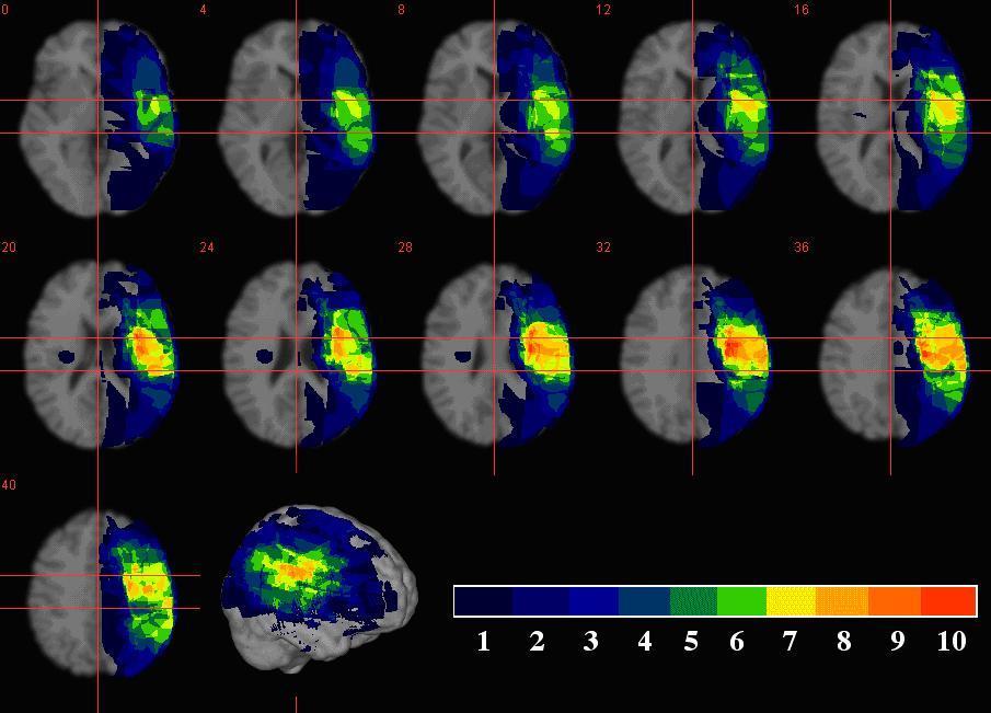 Come trarre correlazioni anatomo-cliniche partendo dalla