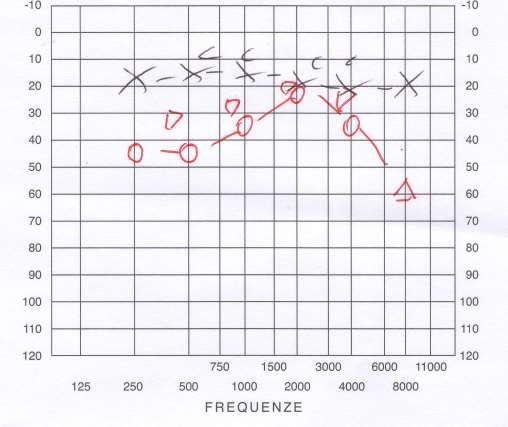 1000 Hz per introdurre il