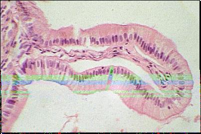 perissosomi: digestione e reazioni ossidative reticolo endoplasmatico e apparato del Golgi: smistamento