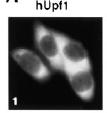 addizionali Protein chinasi SMG7 SMG5 SMG6