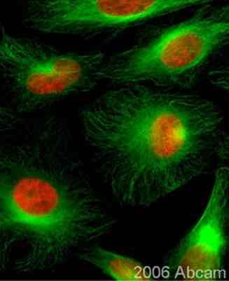 chromosmes Centrosoma