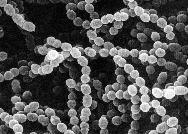 Streptococcus thermophilus Temperatura ottimale di sviluppo 42-48 C Omofermentante Ossigeno indipendente ph < 5,7 Cocco