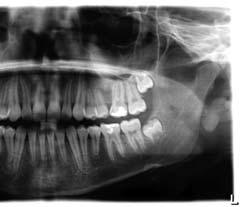 Percorso stratigrafico specifico con ingrandimento costante 1,25, per calibrare e confrontare misure con un repere.