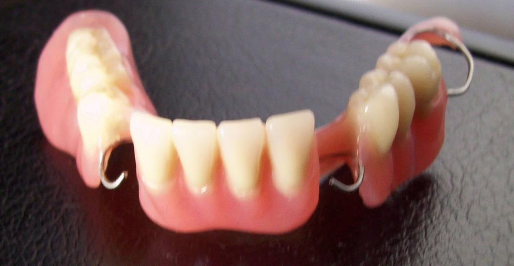 Come Fabbricare La Protesi Dentaria Mobile Parziale Con Ganci 1 Parte Scritto Da Pirrelli Roberto Pdf Free Download