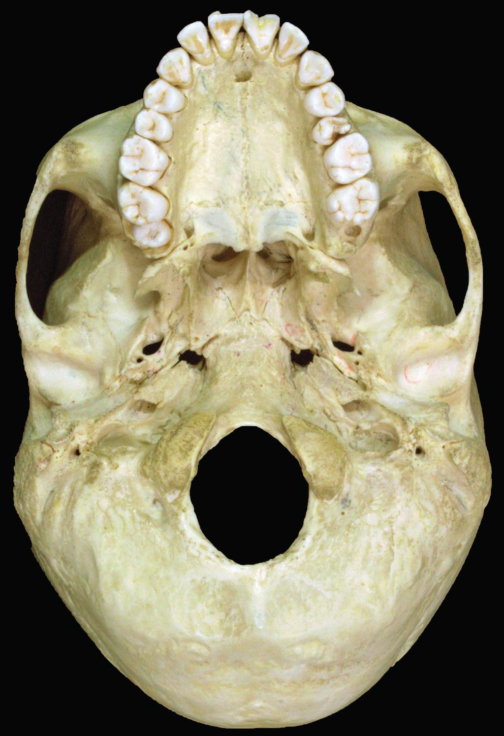 Anatomia sistematica del distretto craniofacciale CAPITOLO 1 Visione inferiore (Figg. 1.11 e 1.