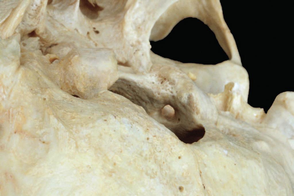 articolare del temporale Coane nasali VOMERE ovale lacero TEMPORALE stiloideo carotideo giugulare Clivo dell occipitale Condilo OCCIPITALE