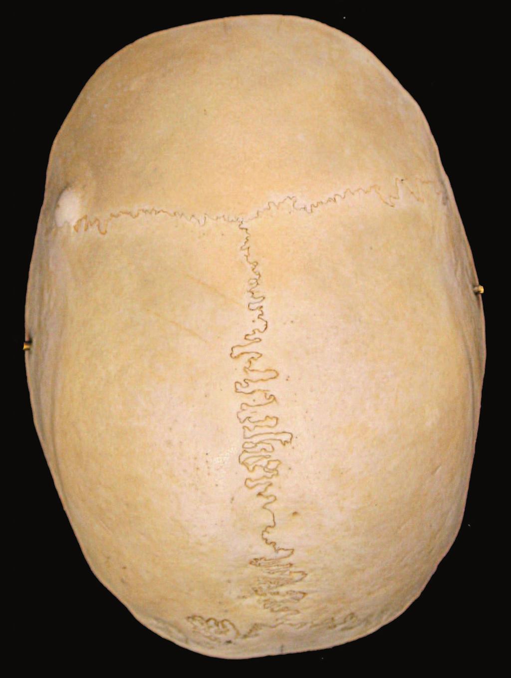 Anatomia sistematica del distretto craniofacciale CAPITOLO 1 