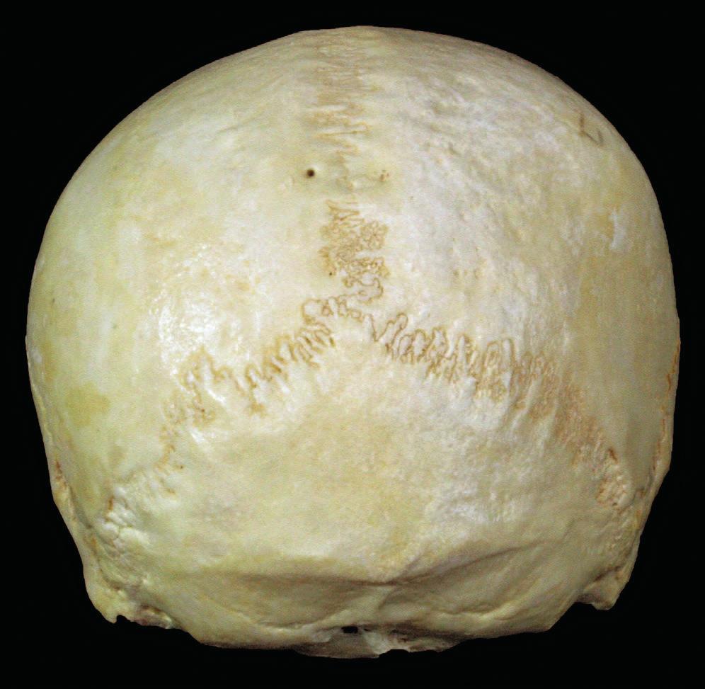 5) Bregma FRONTALE coronale PARIETALE sagittale parietale Lambda lambdoidea OCCIPITALE Fig. 1.