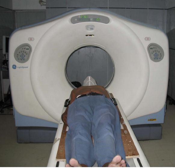 vedere il tumore TC imaging tomografico 3D visualizzazione tumore / organi sani / contorni corporei