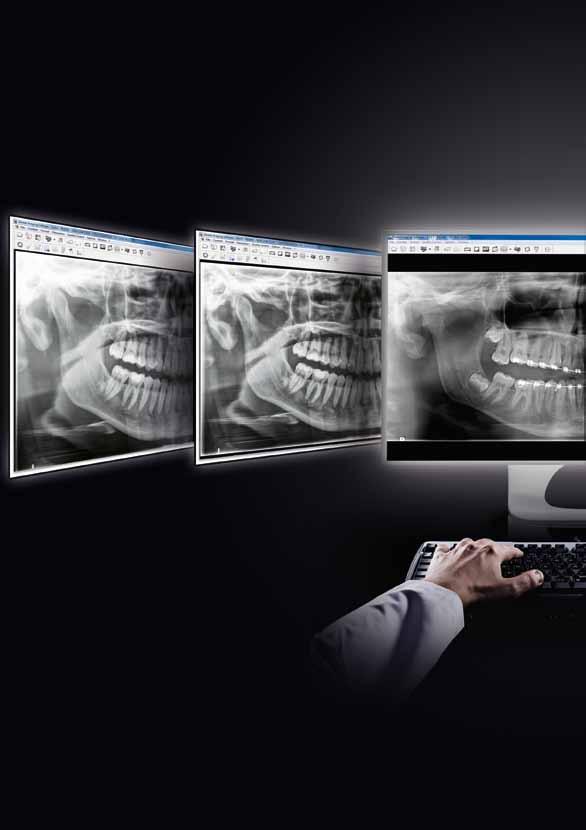 Software che fa una chiara differenza Adapt Contrasto Adapt T-Mat Senza CS Adapt L'upgrade del vostro Carestream Dental Imaging Software con il modulo CS Adapt vi offre: Sei