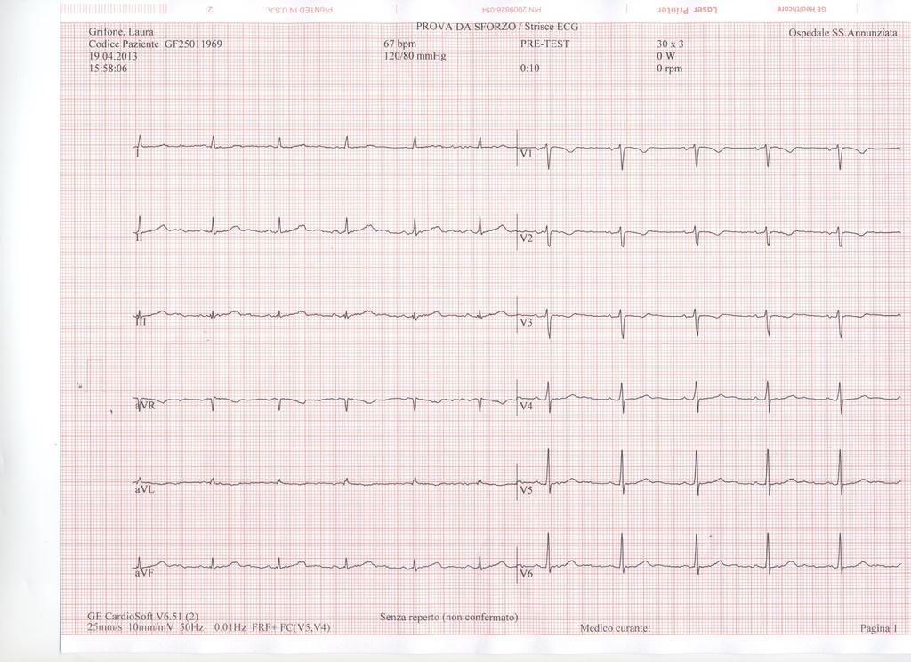 Un ECG