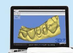 digitale sistemi CAD/CAM leghe dentali sistemi di rifi