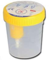 Presso il CUP/ufficio informazioni o qualunque farmacia: un contenitore con tappo a vite della capacità di 120 ml con sonda di campionamento 3.