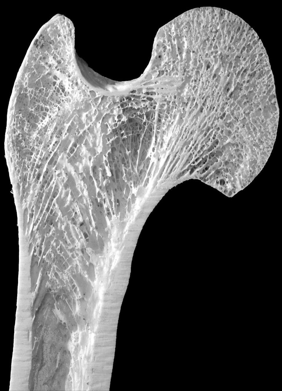 Tessuto osseo Epifisi prossimale del femore: