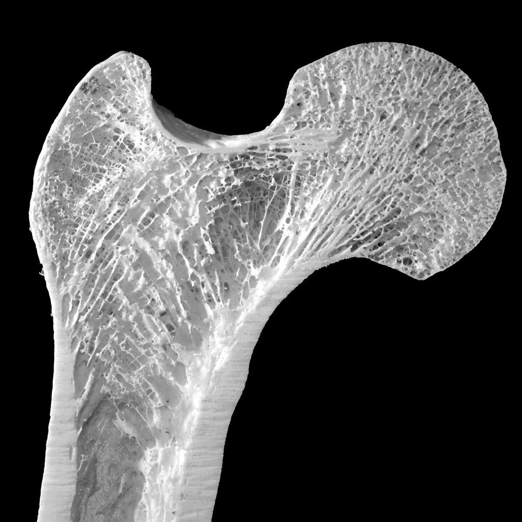 Struttura macroscopica dell osso Osso spugnoso (trabecolare o spongioso)