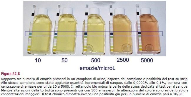 Emoglobina e mioglobina Alterazioni del colore sono evidenti a concentrazioni di emazie maggiori rispetto alle