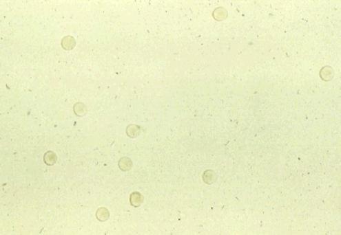 Cellule: globuli rossi (ematuria) Morfologia normale: