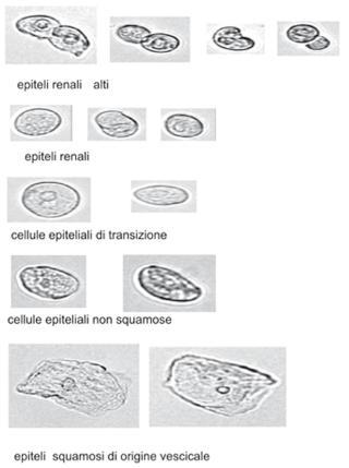 Cellule epiteliali Valori di riferimento: poche unità per campo. Rappresentano il normale sfaldamento delle cellule senescenti.