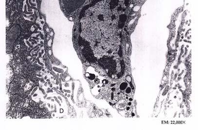 (pseudopodi) del macrofago che si estendono come colletti per inghiottire i