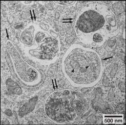 Analisi al Microscopio Elettronico di fibroblasti di embrione di topo cresciuti in mezzo povero di nutrienti.