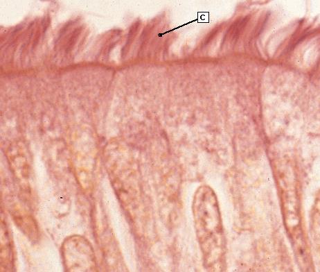 Trachea In alcuni 