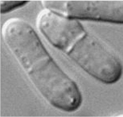 : Candida è un lievito che può formare strutture filamentose dette PSEUDOMICELIO, sulle quali possono formarsi le blastospore Blastogonia Schizogonia setto divisiorio blastospore