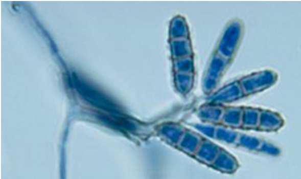 (2) Spore contenute in uno sporangio Sporangiospore Sporangio Generi: Mucor spp. Rhizopus spp. Absidia spp.