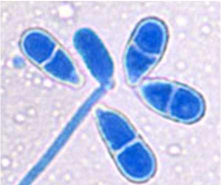 (4) Spore prodotte all interno o all estremità dell ifa Sporangioforo Genere: Tricoderma spp.