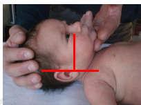 Il protocollo PBLS (Pediatric Basic Life Support) (fase A) RCP - massaggio