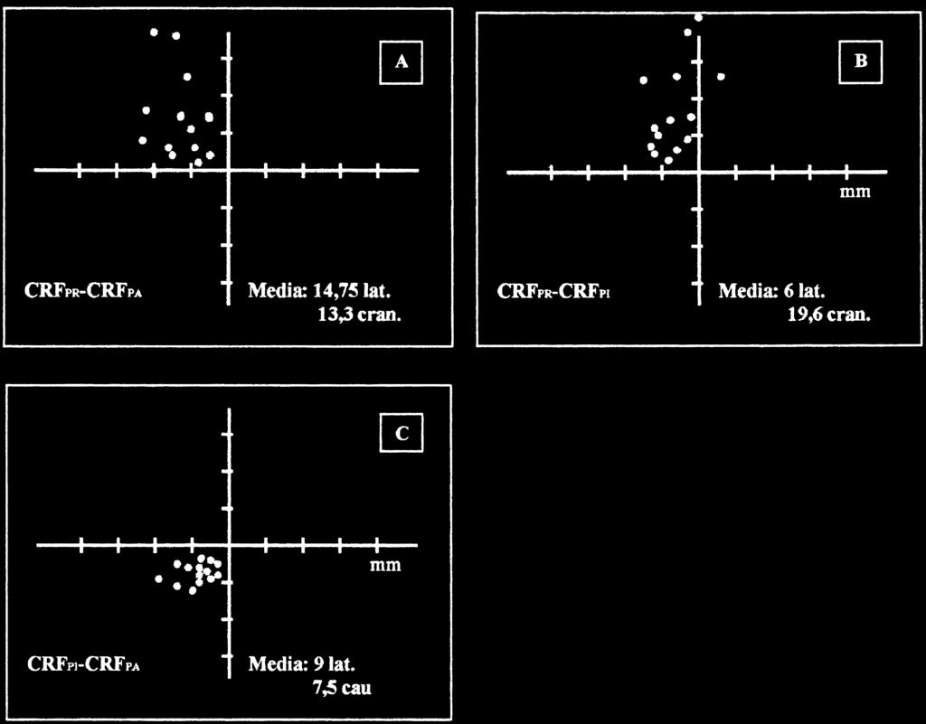 C. Villani, M.C. Giordano, P. Astorri Fig. 3. Applicazione del metodo di Pierchon et al. in esiti di D.C.A. bilaterale.