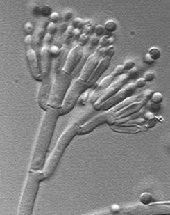 Catenelle di conidi Penicillium sp.