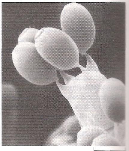 costituito da cellule uninucleate -Micelio secondario,