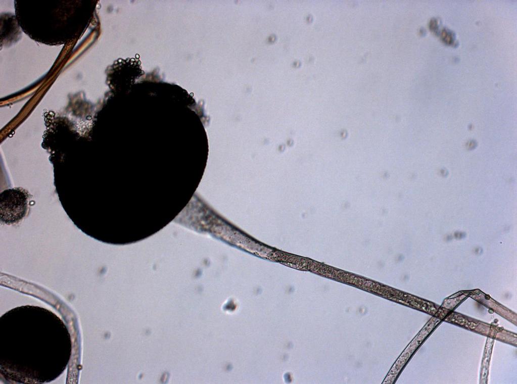 Rhizopus stolonifer (ZIGOMICETI) È la comune muffa nera del pane spore sporangio (Foto Fattorini L.