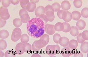 EOSINOFILI Gli eosinofili sono abbastanza rari nel sangue. La loro dimensione è la stessa dei neutrofili.