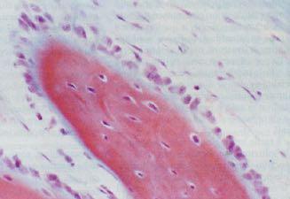5 Lacuna di Howship (Membranosa > periostale ed endostale) orletto striato Ossificazione Mesenchima