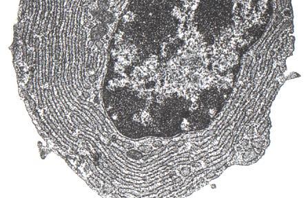 polysomes NH2 COOH In vitro