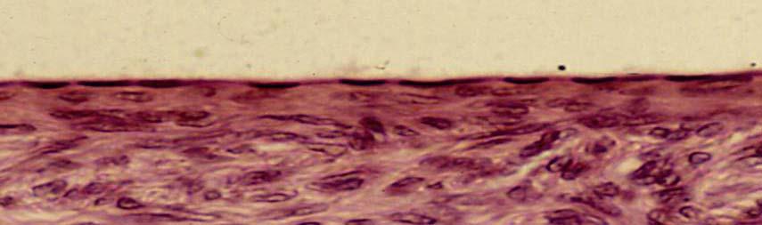 Lo ritroviamo: negli alveoli polmonari in alcune parti del rene (foglietto parietale della capsula del BOWMAN,