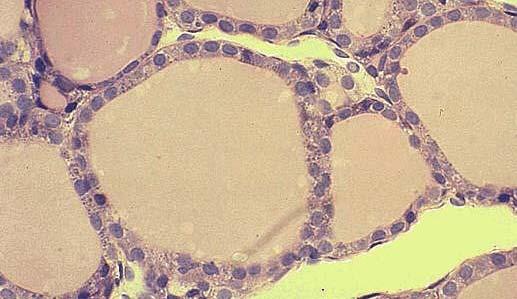 EPITELIO CUBICO SEMPLICE L'epitelio cubico semplice è costituito da cellule che hanno larghezza ed altezza uguali e assumono l'aspetto di bassi prismi, in genere a sei facce, dotati di un