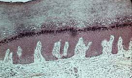 costituiscono una sorta di membrana protettiva più o meno spessa chiamata " strato corneo".