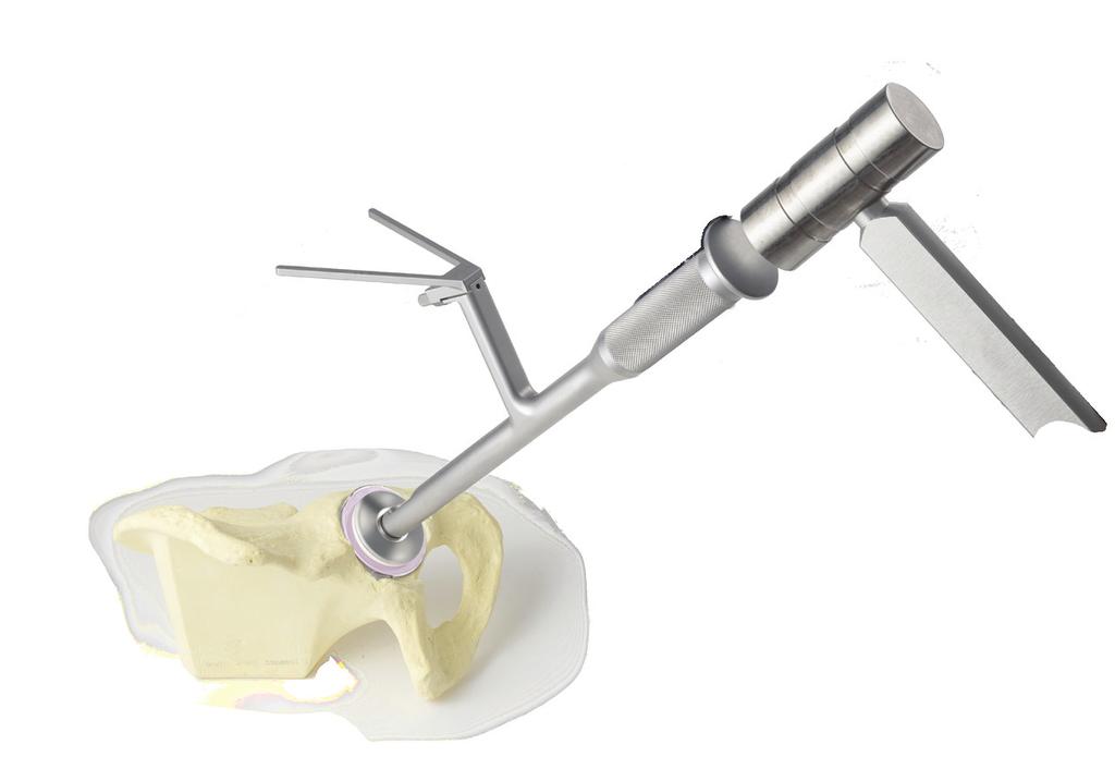 L impattatore del cotile viene utilizzato dal chirurgo per le impattazioni finali. Gi impattatori vengono utilizzati per garantire il corretto press-fit del cotile Maxera (Fig. 22).