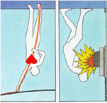 Effetti fisiopatologici della corrente elettrica L elettrocuzione, detta comunemente scossa, consiste nell attraversamento del corpo umano da parte di una corrente elettrica.