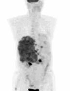 tumours as small as 2 mm.