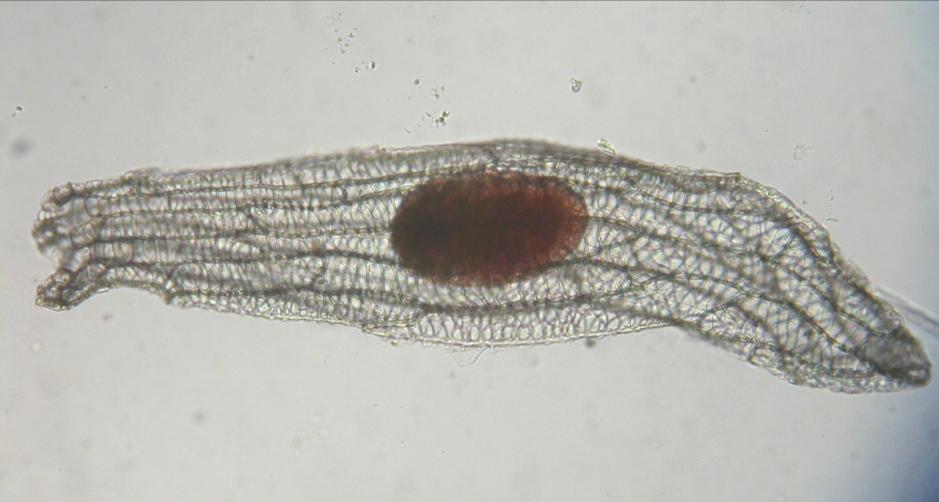 Nel seme non ci sono tessuti di riserva: mancano sia endosperma che cotiledone Foto: E.