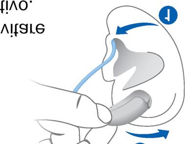 Inserimento e rimozione degli apparecchi acustici L'apparecchioacusticoèstatofinementeregolato perl'orecchiosinistroel'orecchiodestro.