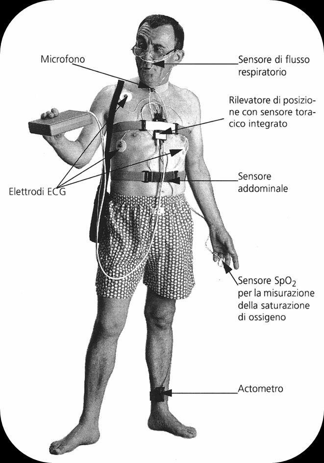 Tecniche di registrazione Flusso oronasale Sensore di russamento ECG Sensore posizione corporea Fascia toracica (sensore