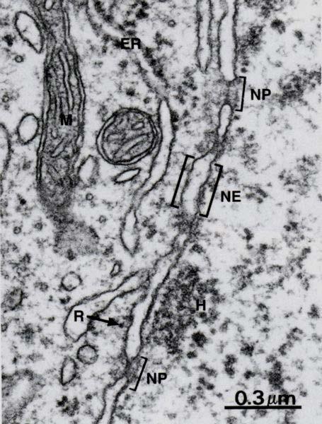 Organelli Cellulari Nucleo, Mitocondri (e Autofagosomi )